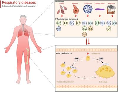 Osteoporosis in Patients With Respiratory Diseases